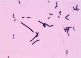 Clostridium chauvoei