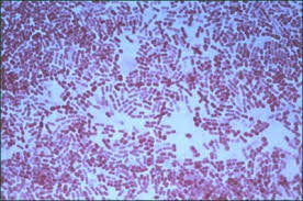 Mycobacterium bovis, responsable de la tuberculosis en bovinos