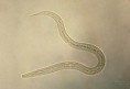 /album/bacterias-virus-y-parasitos/nematodos-jpg/